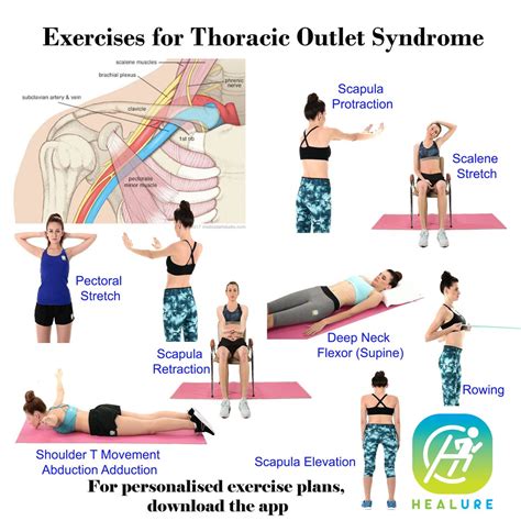 Thoracic Outlet Exercises