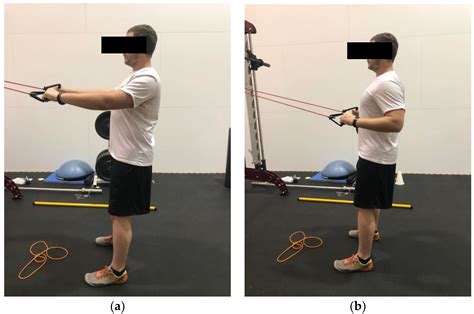 Thoracic Outlet Syndrome Biomechanical And Exercise Considerations