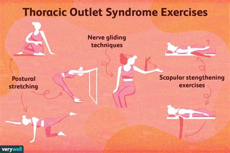 Thoracic Outlet Syndrome Physical Therapy What To Expect