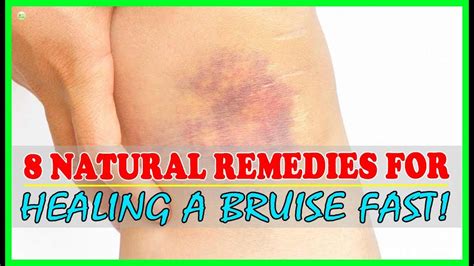 Thumb Bruise Treatment: Fast Relief