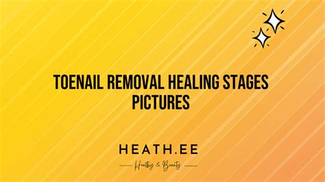 Toenail Removal Healing Stages Pictures A Comprehensive Guide Heathe