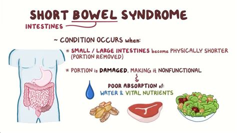 Tpn Short Bowel Syndrome 12 Hours/Day