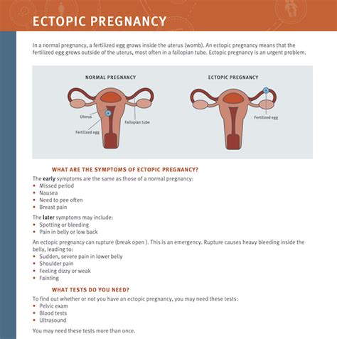 Treatment Of Ectopic Pregnancy Asnachicago