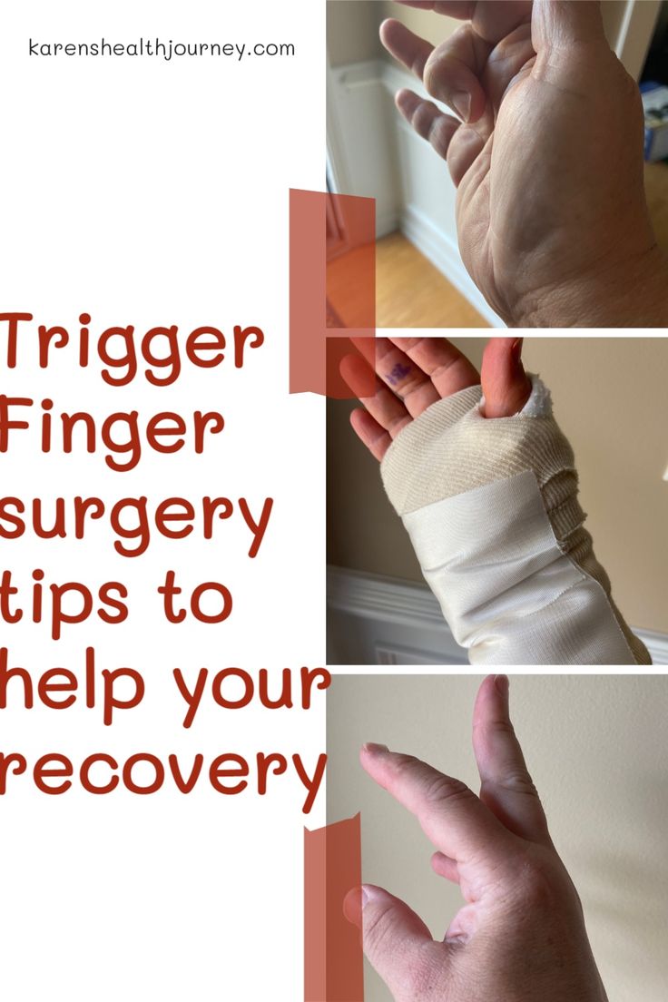 Trigger Finger Operation Recovery