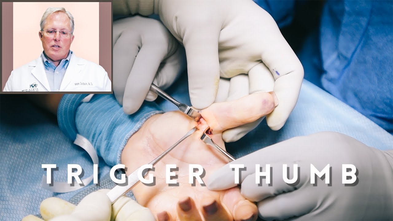 Trigger Finger Shots Surgery Recovery Youtube