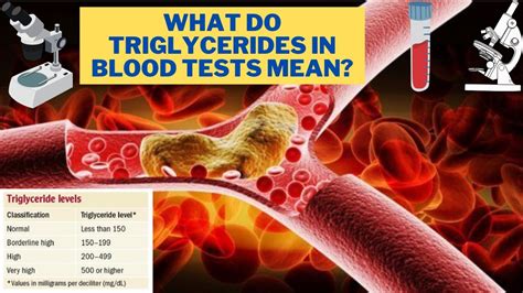 Triglyceride Level Information Mount Sinai New York, 45% Off