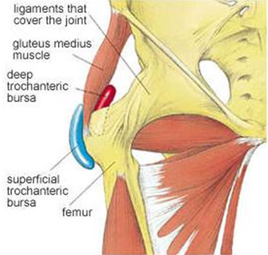 Trochanteric Bursitis Sports Medicine Doctor Mesa Az Orthopedic Surgeon