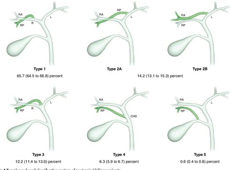 Types Of Biliary Drains