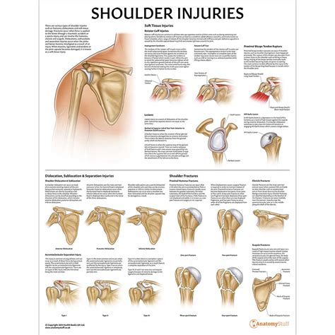 Types Of Shoulder Pain Diagnosis Chart