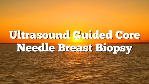 Ultrasound Guided Core Needle Breast Biopsy What To Expect My