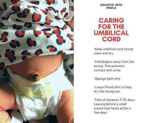 Umbilical Cord Stump Care Guide