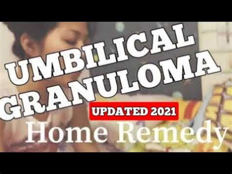 Umbilical Granuloma: Effective Home Remedies