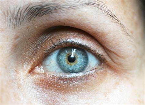 Understanding Common Eye Conditions And Treatments Insights From Eye