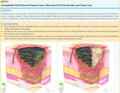 Unstageable Pressure Sore