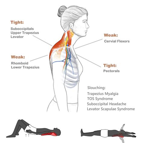 Upper Trapezius Muscle Stretching Relieve Knots Tightness And