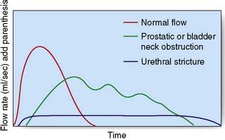 Urethra Dilation: Restore Normal Urine Flow