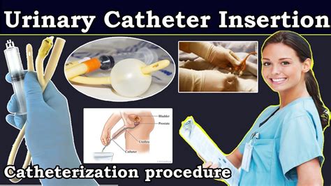 Urinary Catheter Female: Easy Insertion Guide