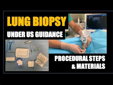 Us Guided Lung Biopsy Procedural Steps And Material Youtube