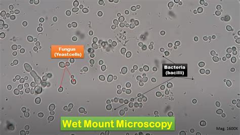 Wbcs On Wet Mount