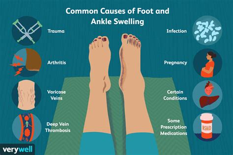 What Causes Ankle Pain Pregnancy? Relief Tips