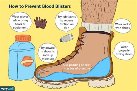 What Causes Blood Bisters? Quick Relief