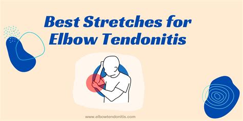 What Causes Elbow Tendonitis? Relief Stretches