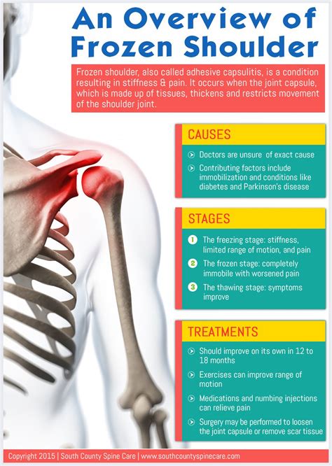 What Causes Frozen Shoulder? Relief Exercises