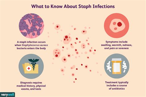 What Causes Staph Infection? Symptoms Guide