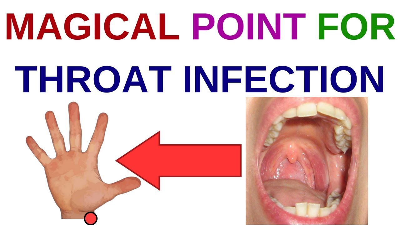 What Causes Throat Infections? Fast Relief Solutions