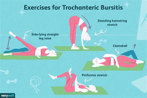 What Causes Trochanteric Bursitis? Relief Exercises