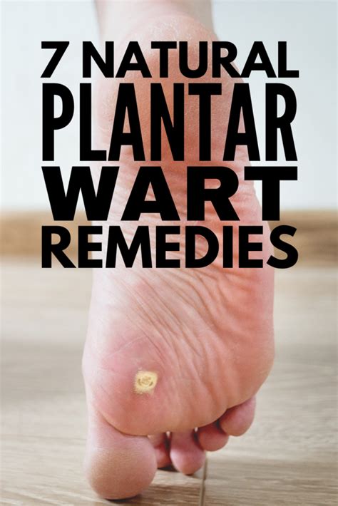 What Causes Warts On Kids' Feet? Home Remedies