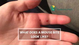 What Do Mice Bite? Protect Yourself