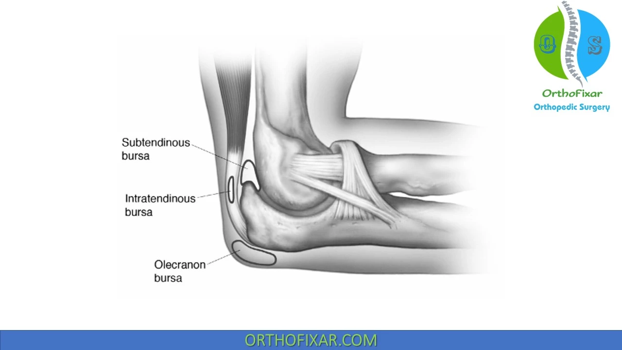 What Exactly Is Elbow Olecranon Bursitis Simplyjnj Olecranon