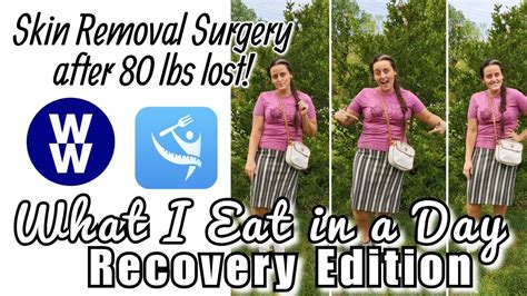 What I Eat Itrackbites Amp Panniculectomy Recovery Update Youtube