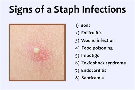 What Is A Staph Infection Symptoms Causes Diagnosis Treatment And