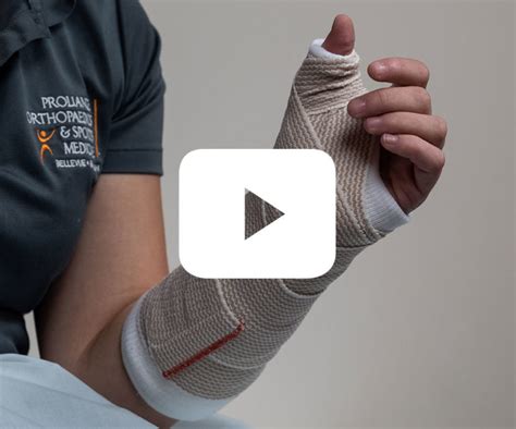 What Is Arm Splinting? Instant Relief Guide