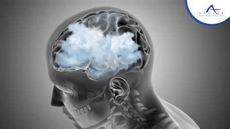 What Is Brain Fog And How Do You Recover From It