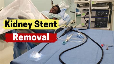 What Is Kidney Stent Removal? A Painless Process