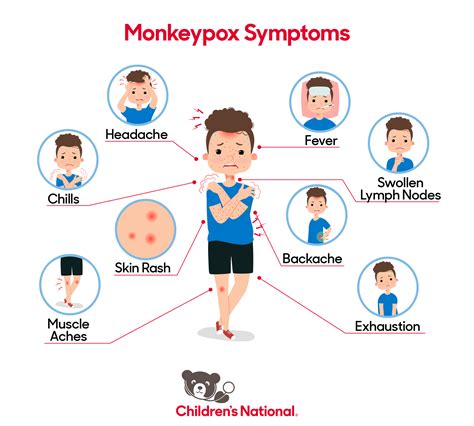 What Is Monkey Pox Alberta? Symptoms Guide