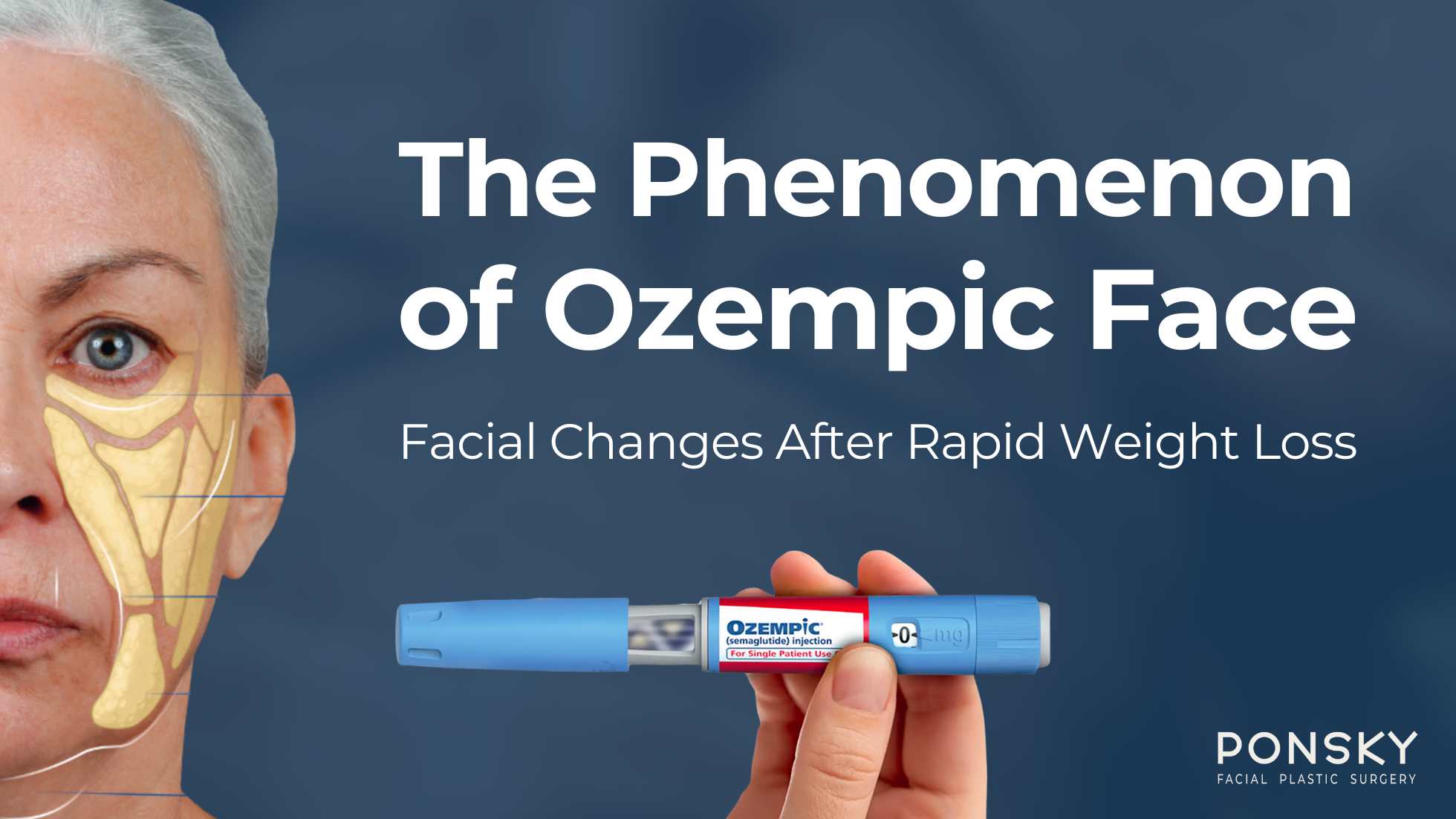 What Is Ozempic Face The After Effects Of Rapid Weight Loss