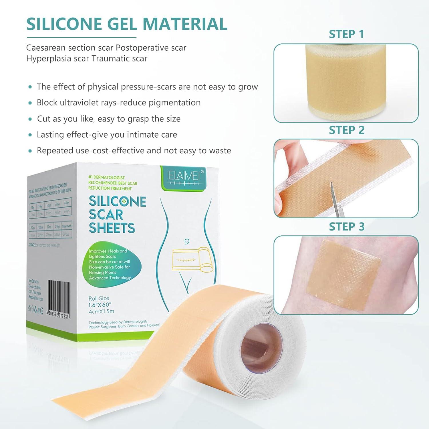 What Is Scar Away Silicone? Effective Scar Removal