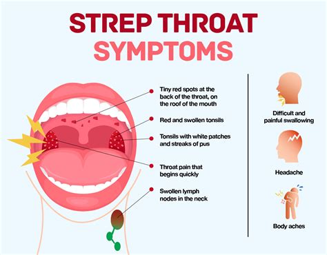 What Is Strep Throat Overview And More