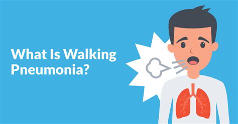 What Is Walking Pneumonia Know Causes Symptoms Treatment And More