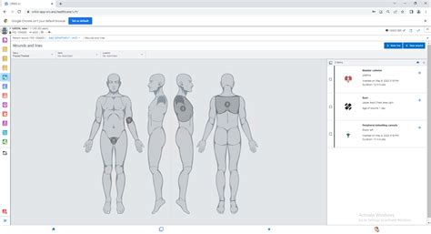 What Is Yale Orbis? Simplify Research