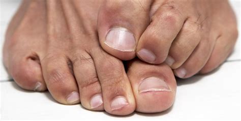 What To Do If You Have A Toe Amputation