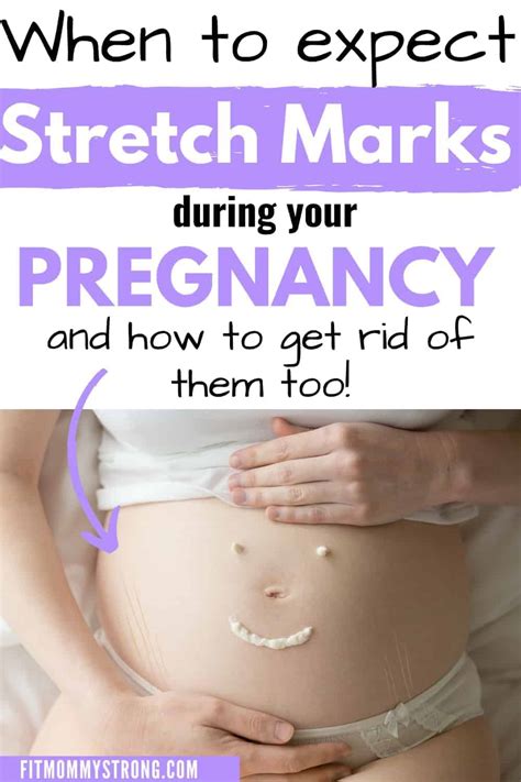 When To Expect Stretch Marks During Pregnancy Mom After Baby