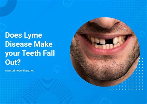 Why Lyme Disease Makes Teeth Fall Out? Fixing Symptoms