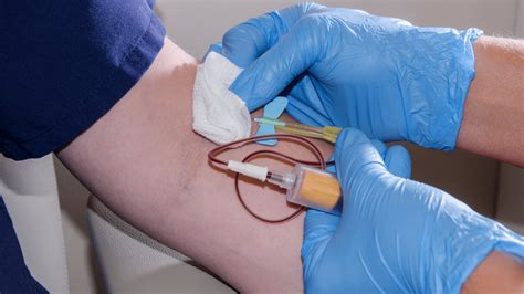 Yale Blood Draw Guide: Easy Prep Tips