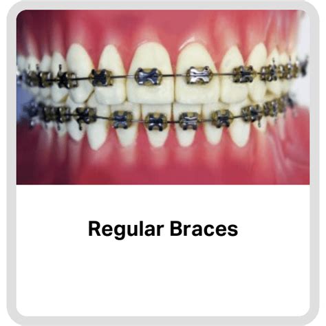 Yale Orthodontics